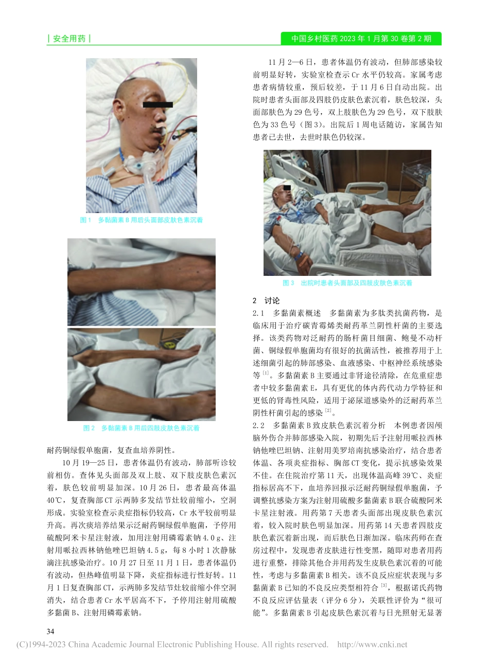 静脉使用多黏菌素B致皮肤色素沉着合并肾功能损害1例_何仁.pdf_第2页