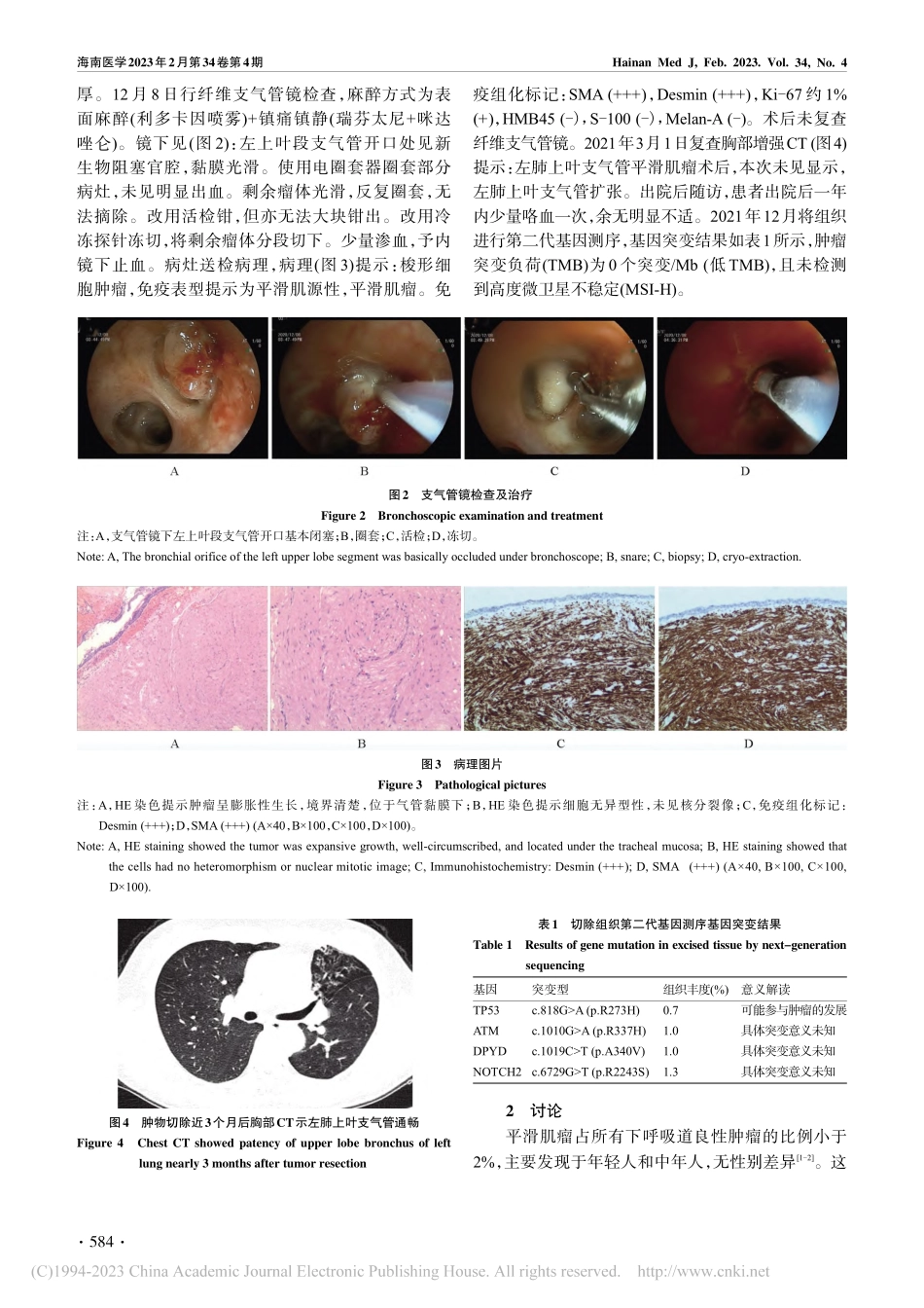 内镜下治疗支气管平滑肌瘤一例_潘婷钰.pdf_第2页