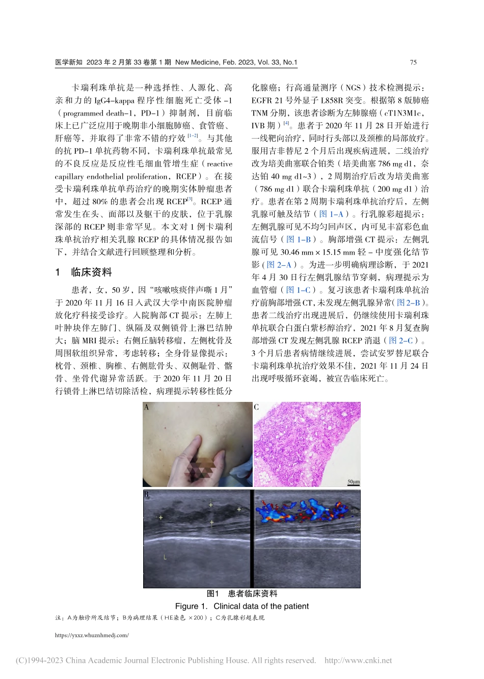 免疫治疗相关乳腺反应性毛细血管增生症1例_揭晨.pdf_第2页