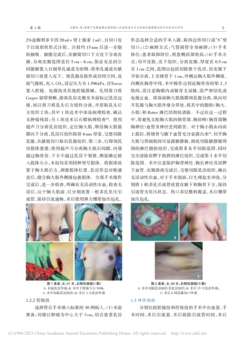 腔镜下乳腺癌根治假体植入乳...乳腺癌根治性手术的对比研究_王静坤.pdf_第3页