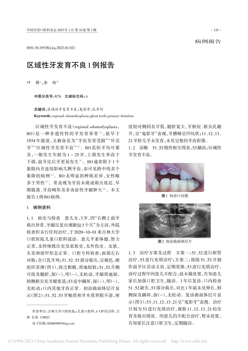 区域性牙发育不良1例报告_叶强.pdf_第1页