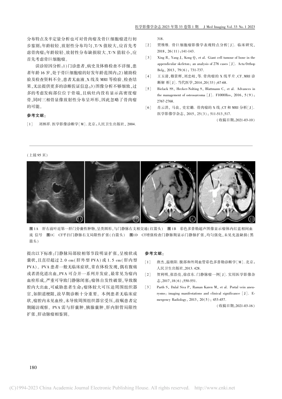 溶骨型骨肉瘤误诊为骨巨细胞瘤1例_石雪.pdf_第2页