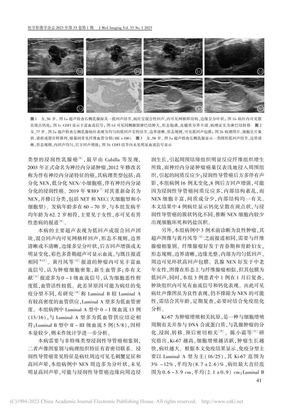 乳腺神经内分泌肿瘤的超声表现与病理对照分析_祁喆.pdf_第3页