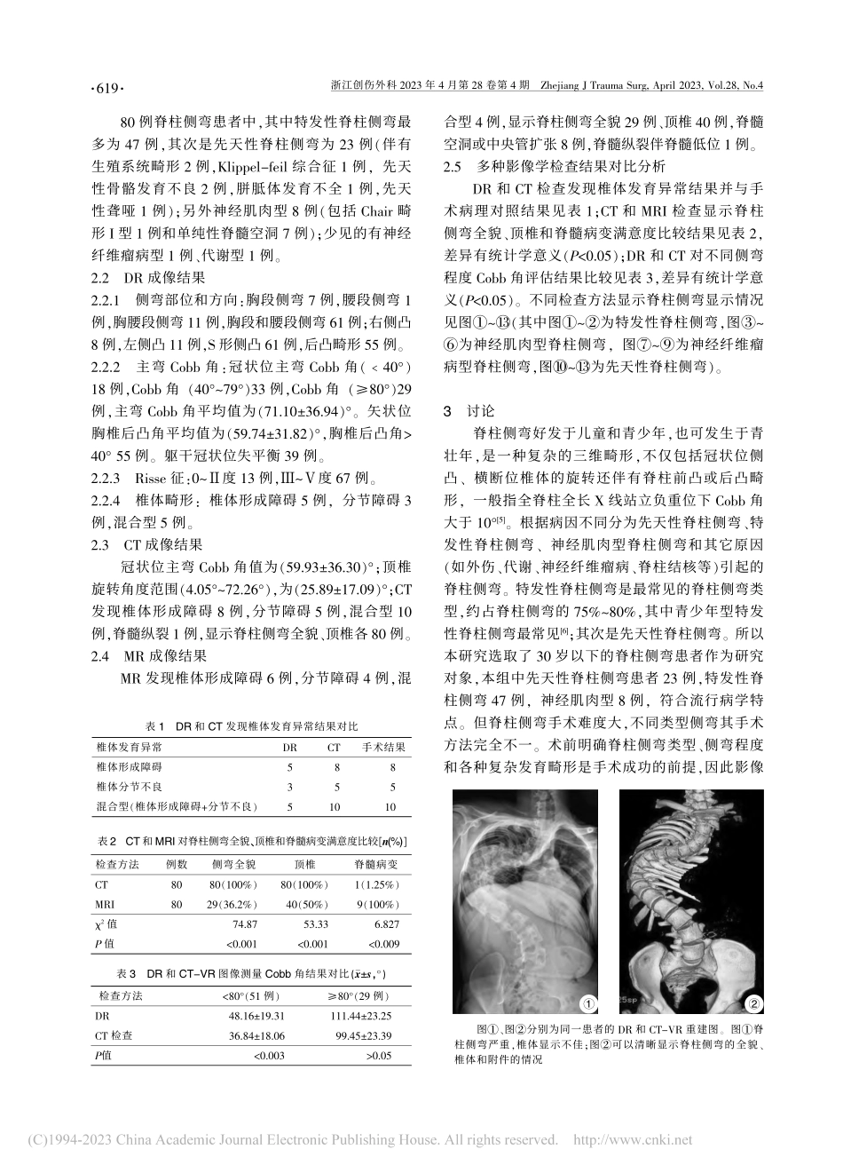 不同影像学检查方法在脊柱侧弯术前评估中的应用研究_侯金丹.pdf_第3页