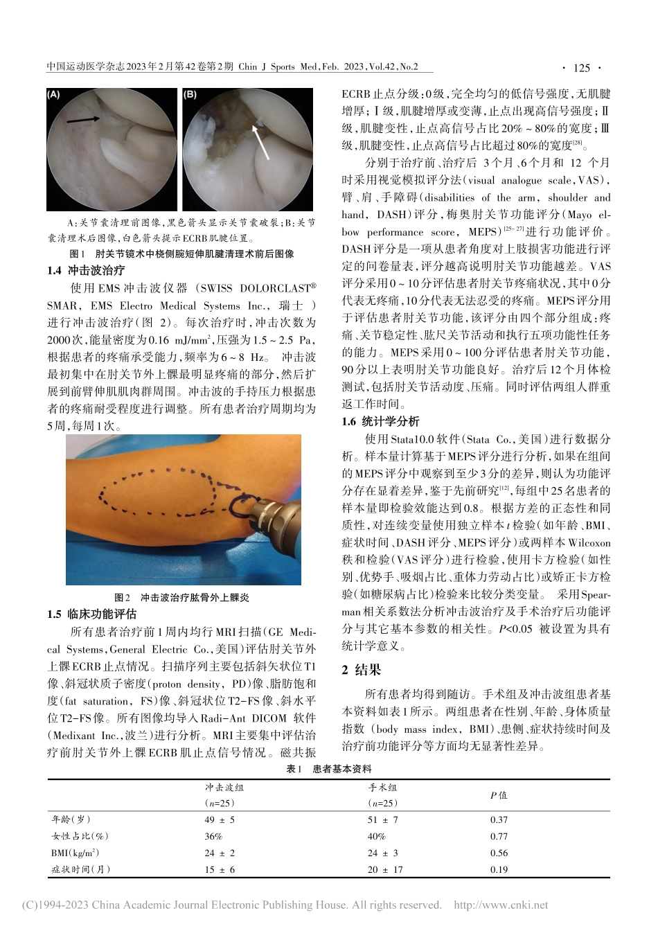 关节镜下桡侧腕短伸肌腱止点...外上髁炎的临床疗效对比研究_李宏.pdf_第3页