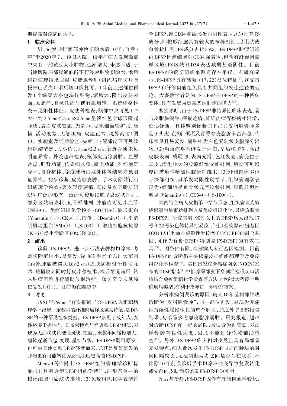 额部纤维肉瘤型隆突性皮肤纤维肉瘤1例_宋萌萌.pdf_第2页