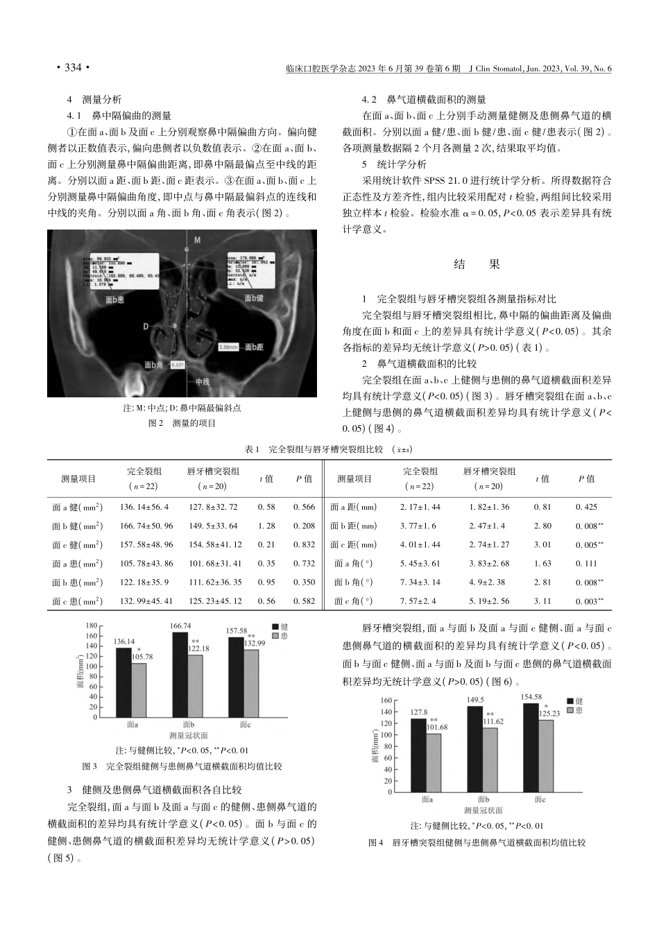伴与不伴有腭裂的单侧唇牙槽突裂患者的鼻气道结构对比_高明.pdf_第3页