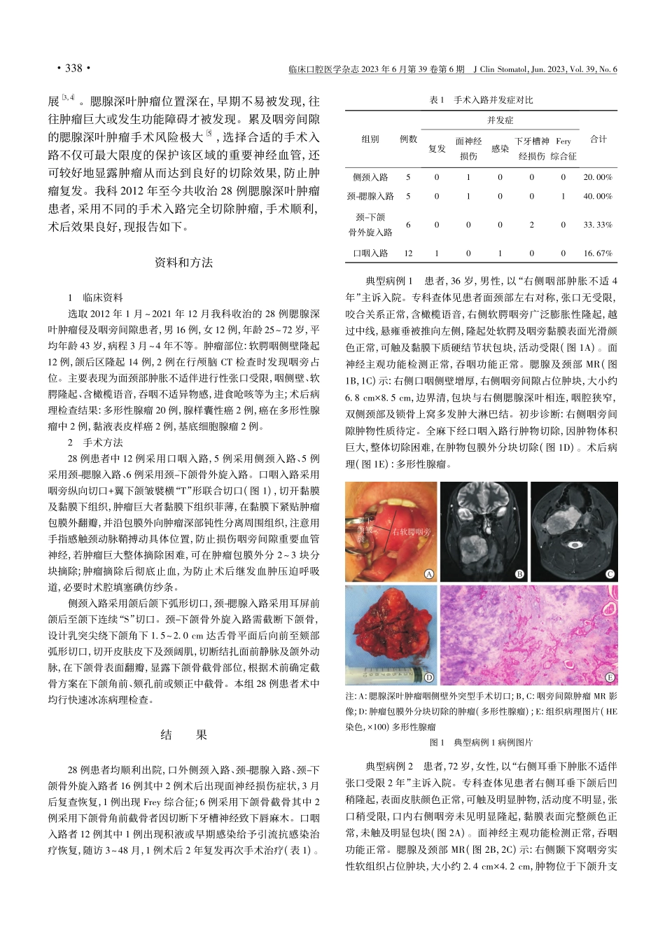 不同手术入路治疗累及咽旁间隙腮腺深叶肿瘤效果分析_高志彪.pdf_第2页