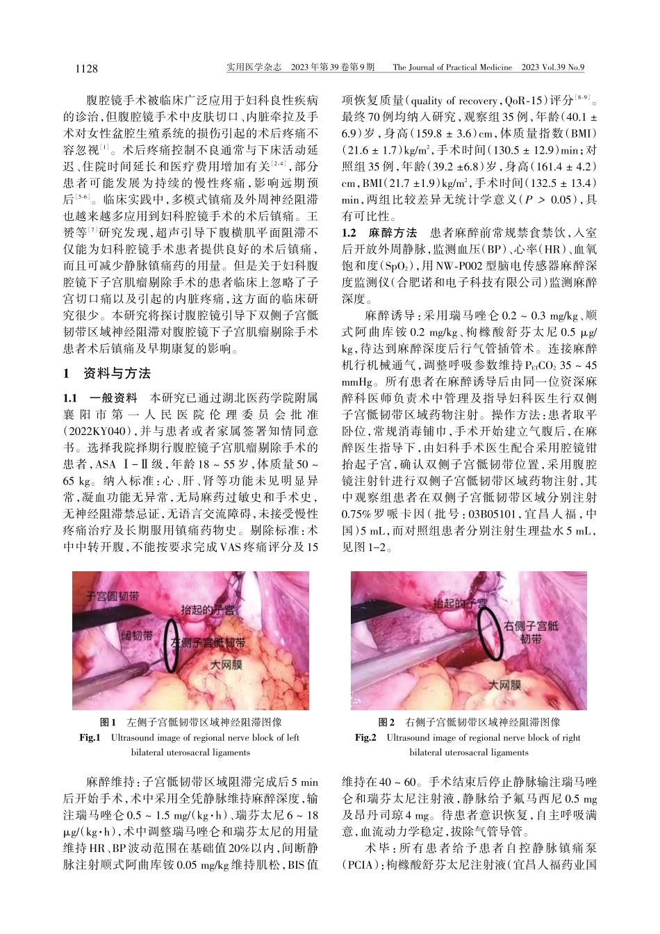 腹腔镜引导下双侧子宫骶韧带...镜子宫肌瘤剔除手术中的应用_汪海金.pdf_第2页