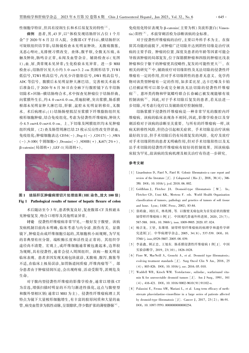结肠浆膜下侵袭性纤维瘤病1例报道_黄凯歌.pdf_第2页