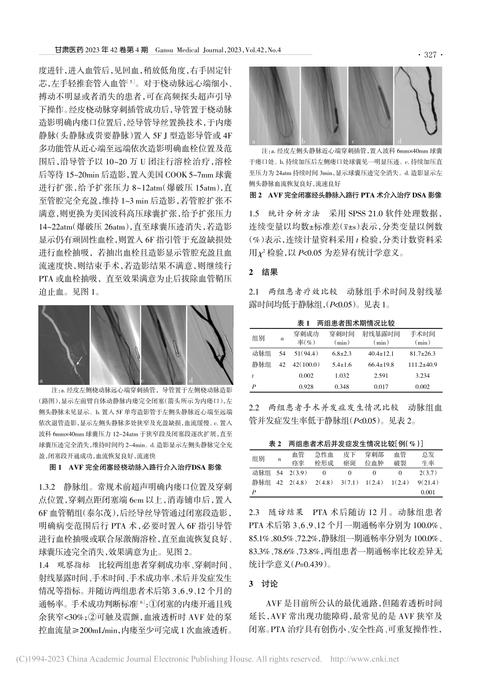 经桡动脉入路治疗自体动静脉内瘘闭塞的疗效及安全性观察_王金宝.pdf_第2页