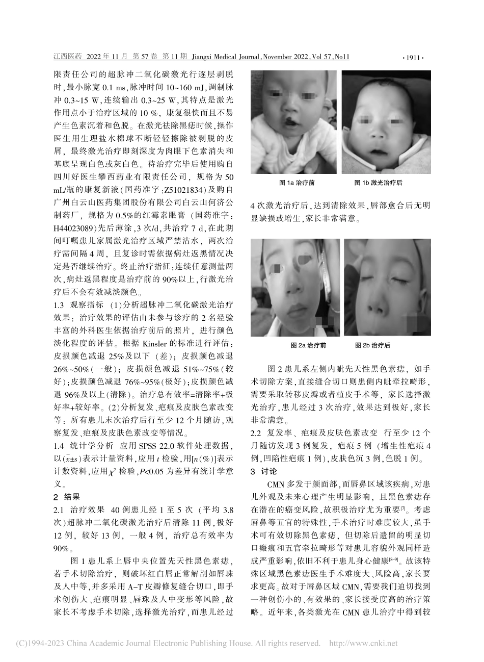 超脉冲二氧化碳激光治疗儿童...域先天性黑色素痣的临床研究_傅荣华.pdf_第2页