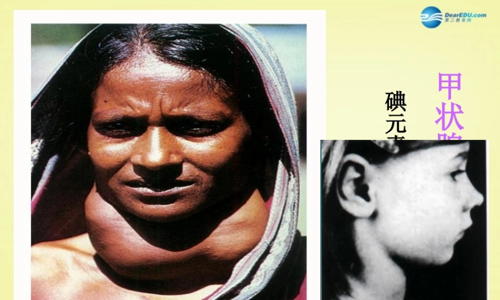 人教初中化学九下《12课题2化学元素与人体健康》PPT课件 (11).ppt