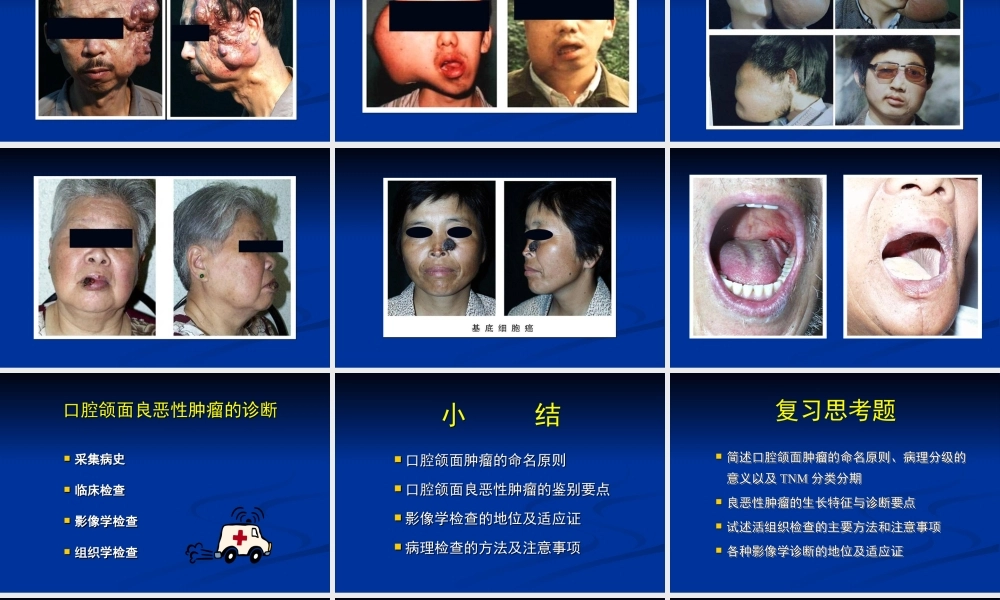 10 口腔颌面肿瘤总论.ppt