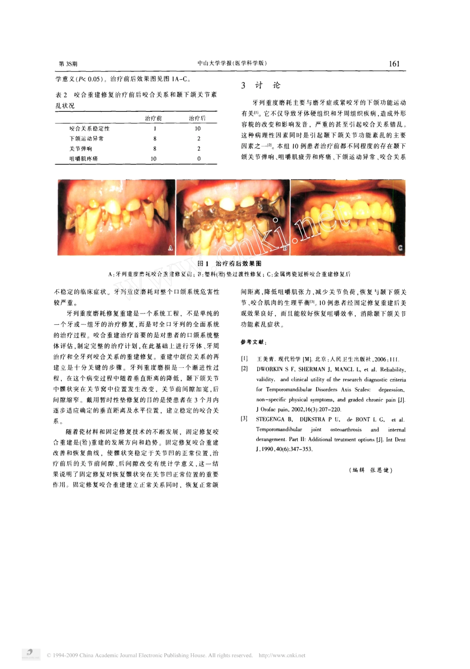 牙列重度磨耗咬合重建修复.pdf_第2页