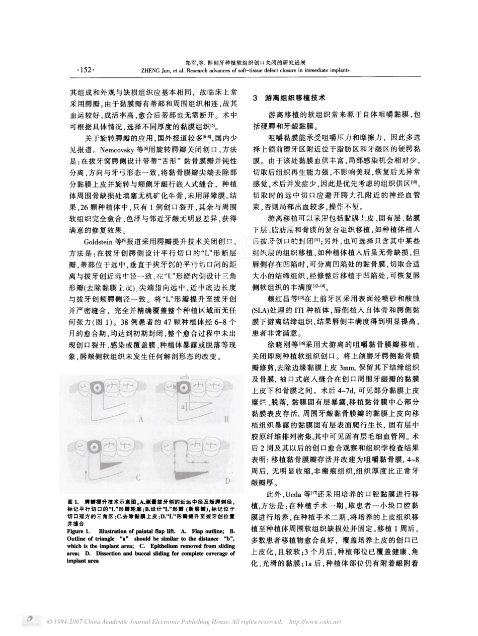即刻牙种植软组织创口关闭的研究进展.pdf_第2页