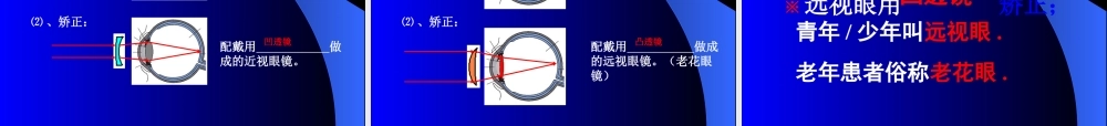 [名校联盟]江西省信丰县西牛中学八年级物理课件：《46神奇的眼睛》.ppt