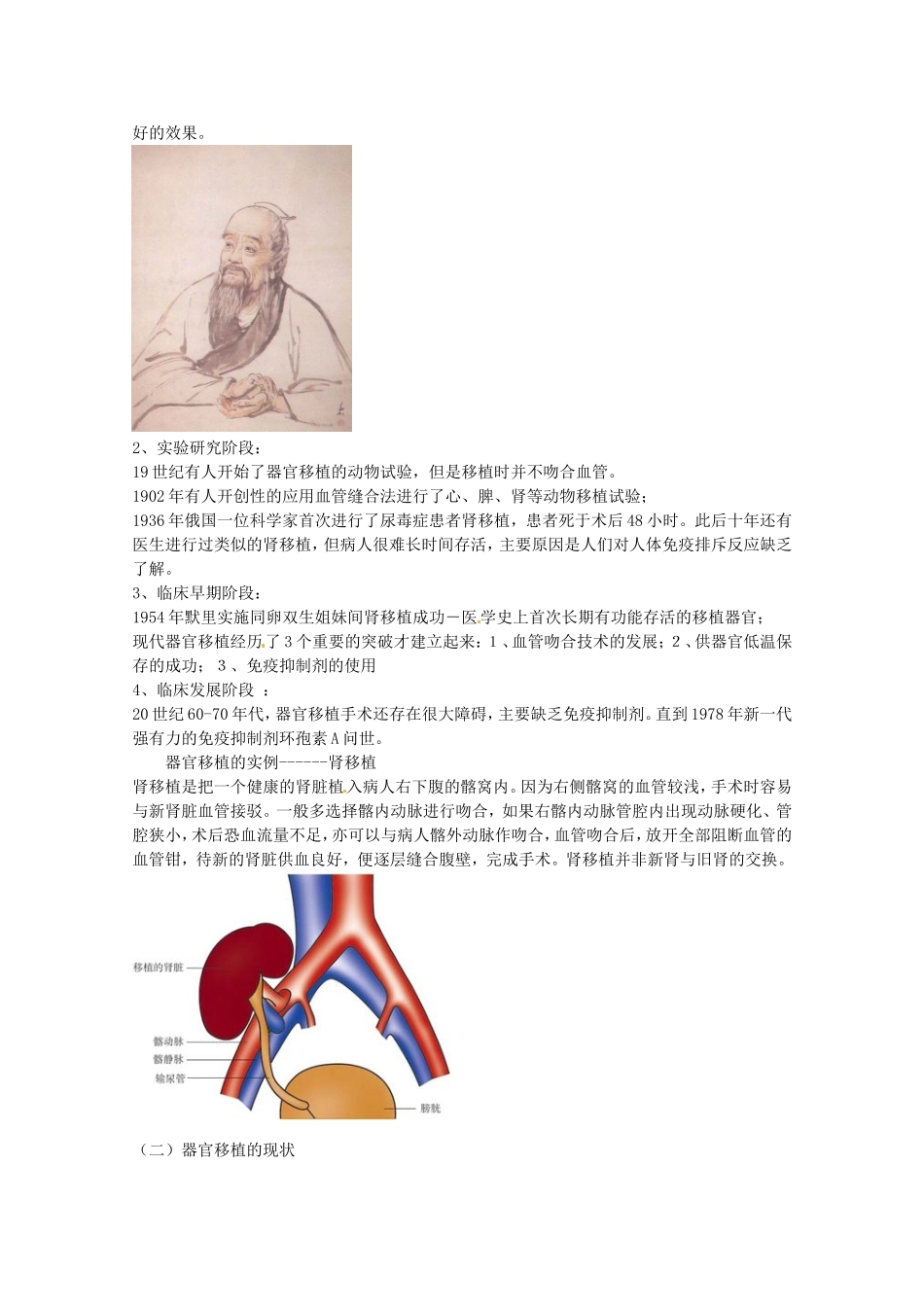 生物：1.3《人体的器官移植》教案（新人教版选修2）.doc_第2页