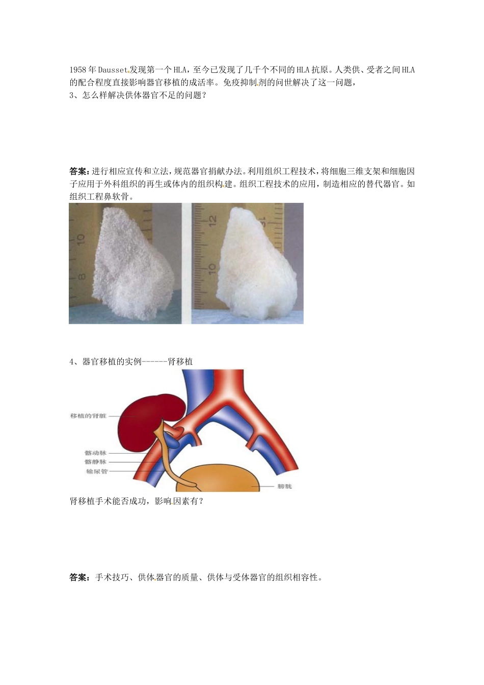生物：1.3《人体的器官移植》学案（新人教版选修2）.doc_第2页