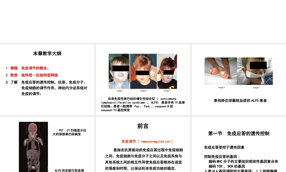 第十六章 免疫调节.ppt