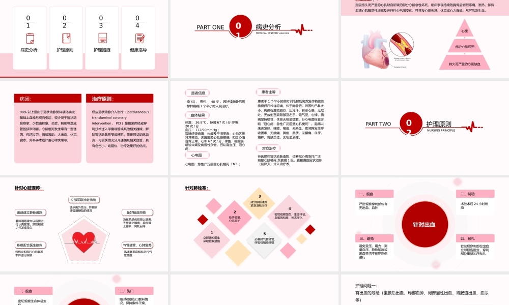 1、急性心梗护理查房完整分析.pptx