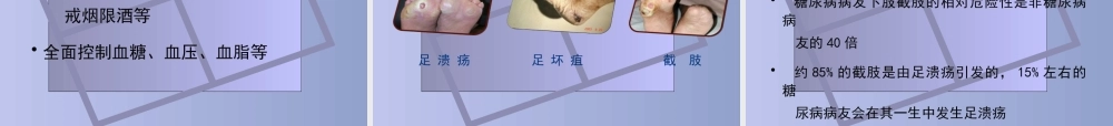 092、糖尿病慢性并发症及防治.pptx