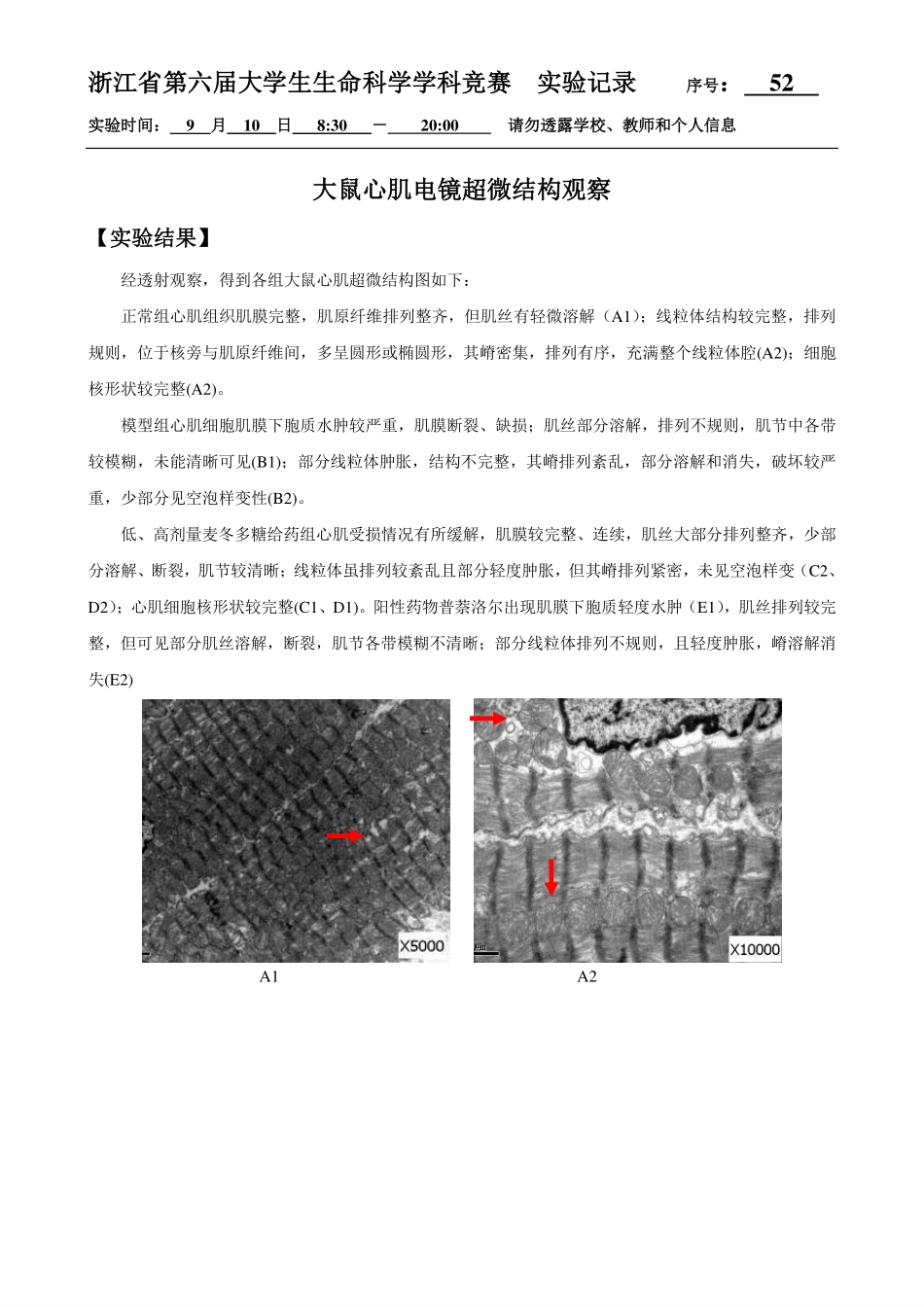 52-0910-大鼠心肌超微结构观察结果.pdf_第1页