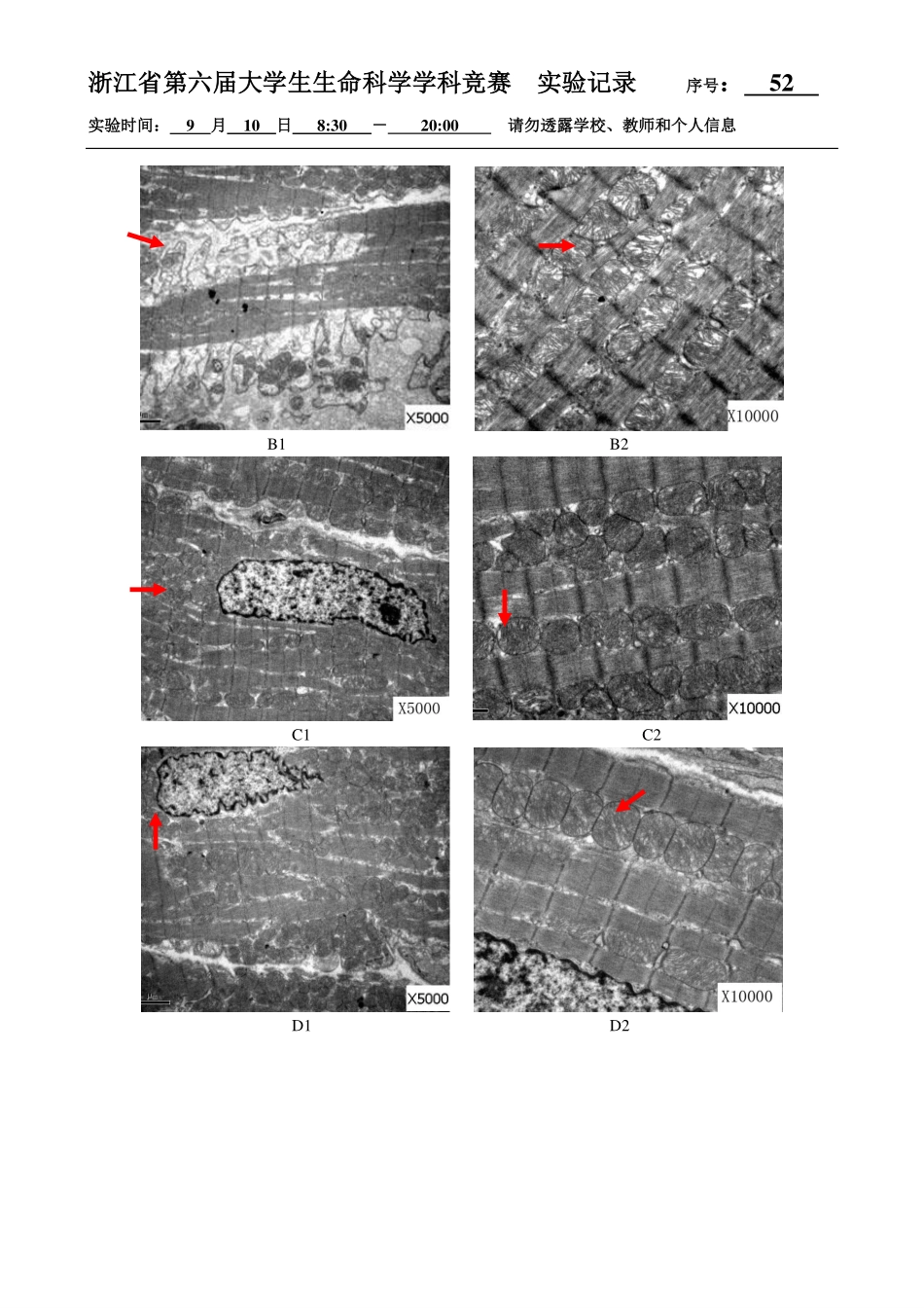 52-0910-大鼠心肌超微结构观察结果.pdf_第2页
