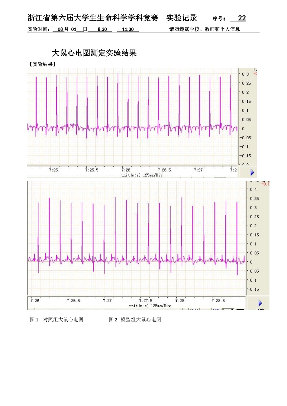 22-0801-大鼠心电图结果.doc_第1页