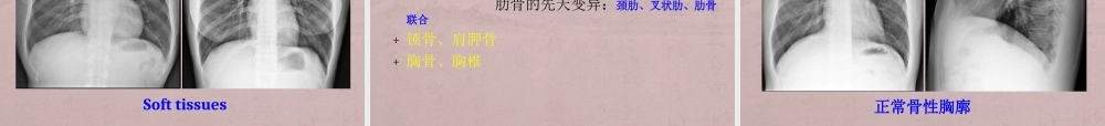 02-（7-1）医学七年制呼吸循环系统教学.ppt
