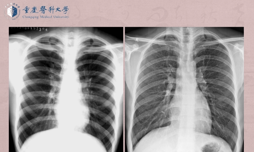 （全是图）医学七年制呼吸循环系统教学.ppt