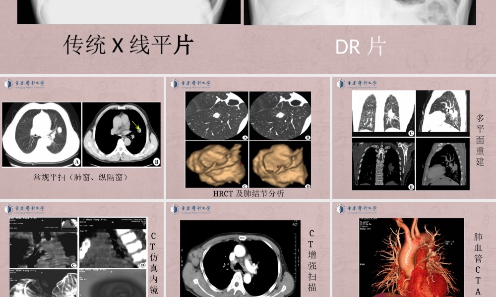 （全是图）医学七年制呼吸循环系统教学.ppt