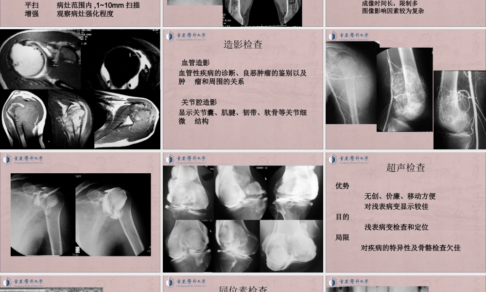 03-骨与软组织七年制.ppt
