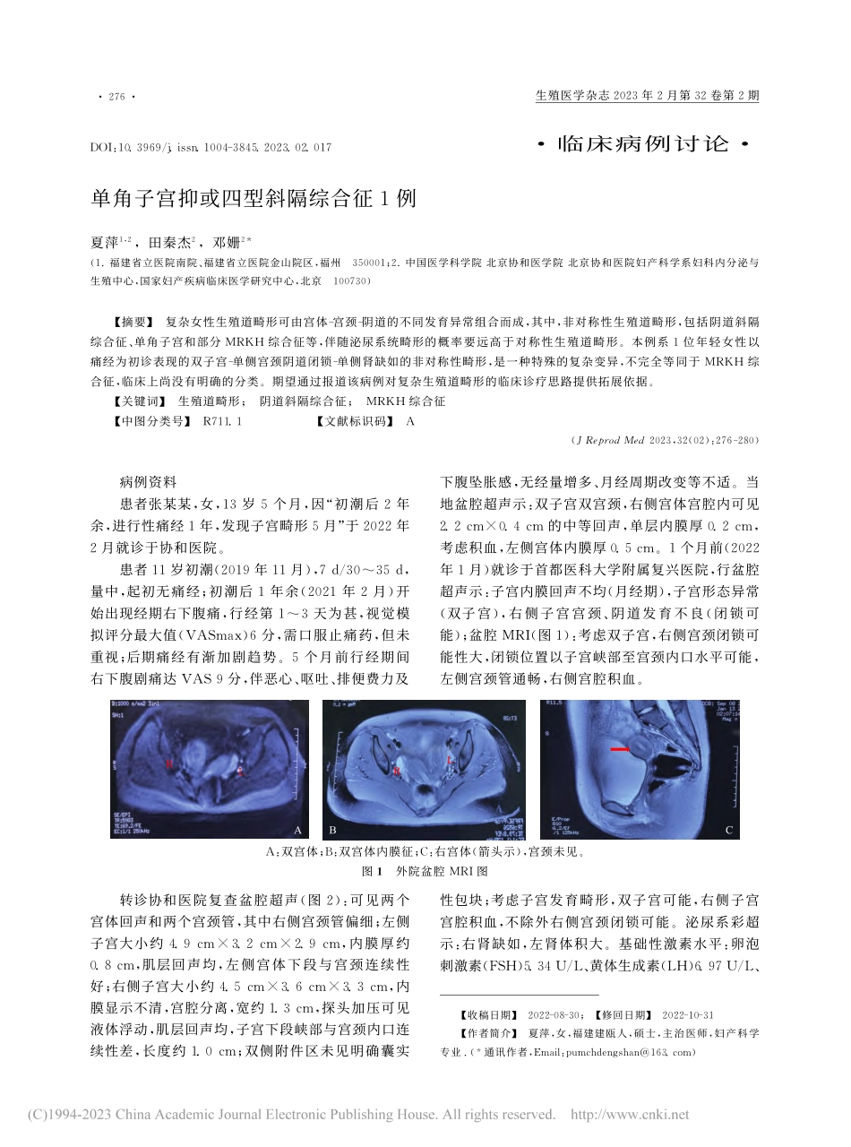 单角子宫抑或四型斜隔综合征1例_夏萍.pdf_第1页