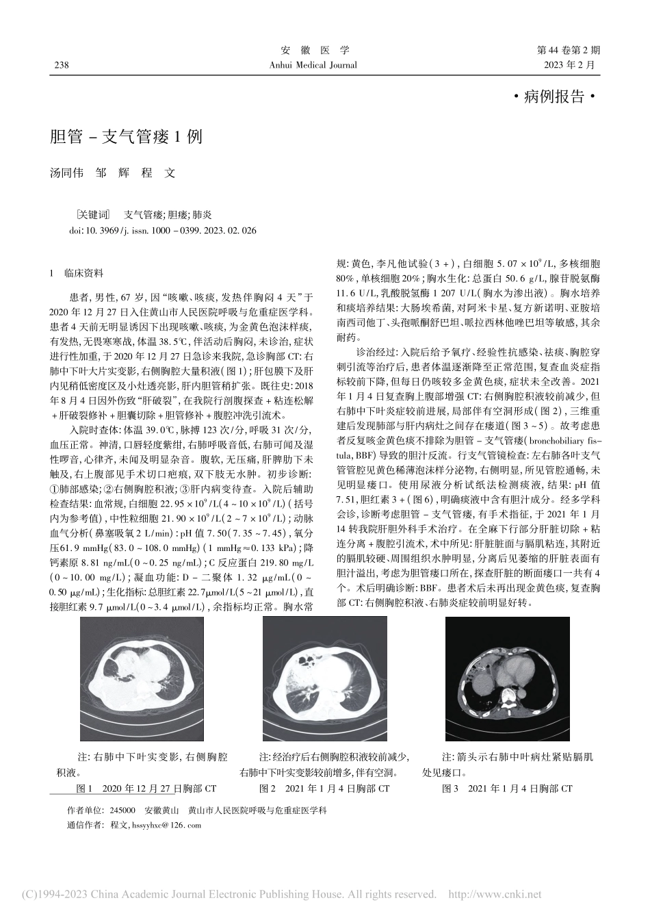 胆管-支气管瘘1例_汤同伟.pdf_第1页