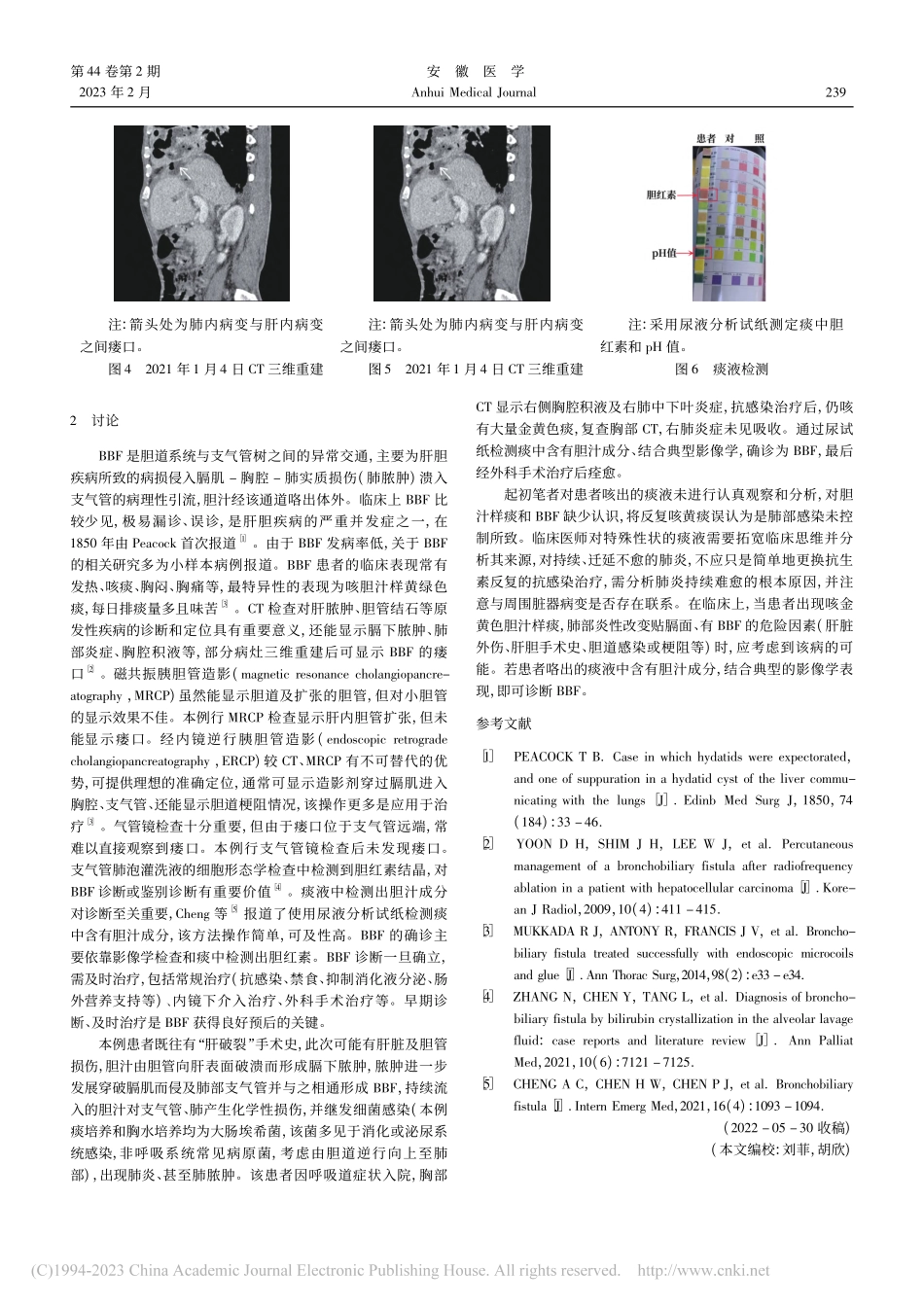 胆管-支气管瘘1例_汤同伟.pdf_第2页