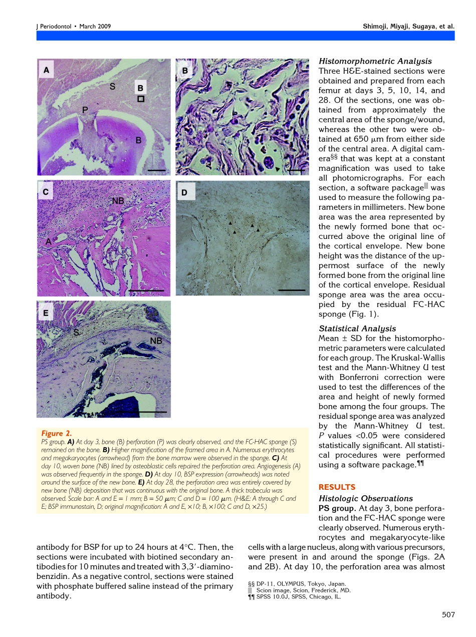bone perforation and placement of collagen sponge facilitate bone augmentation.pdf_第3页