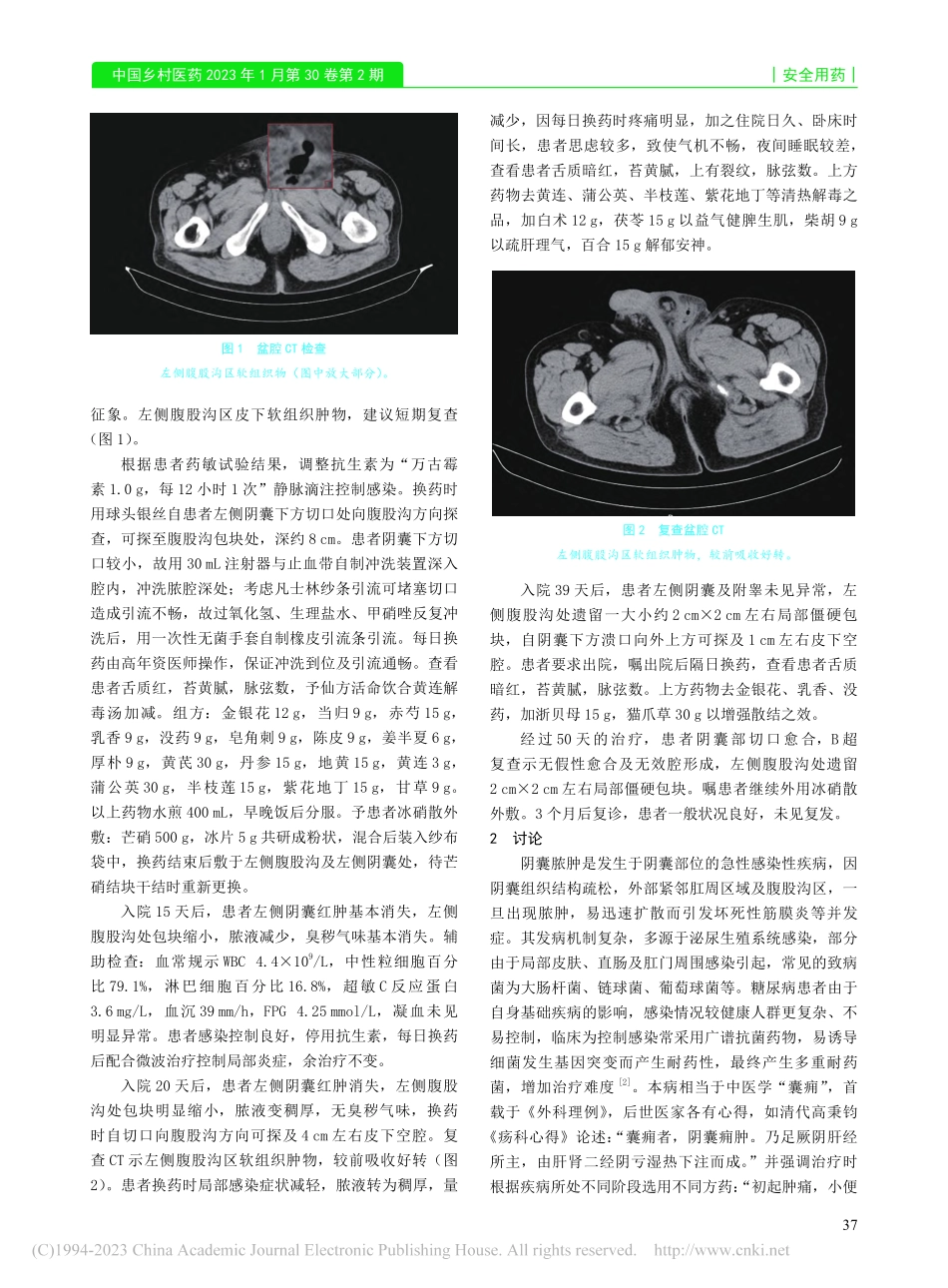 多重耐药菌致阴囊脓肿1例诊治分析_崔慧敏.pdf_第2页
