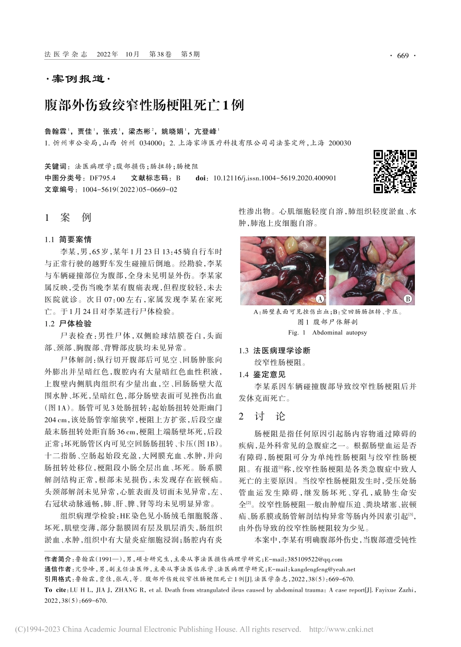 腹部外伤致绞窄性肠梗阻死亡1例_鲁翰霖.pdf_第1页