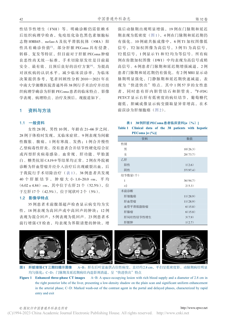 肝脏血管周上皮样细胞瘤38例临床诊治分析_苏文欣.pdf_第3页