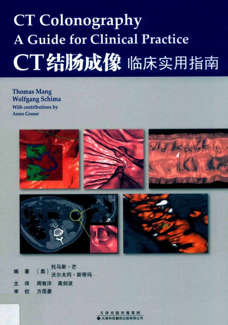 CT结肠成像_（奥）托马斯·芒（Thomas Mang）（奥）沃尔夫冈·斯奇玛（Wolfgang Schima）编著.pdf_第1页