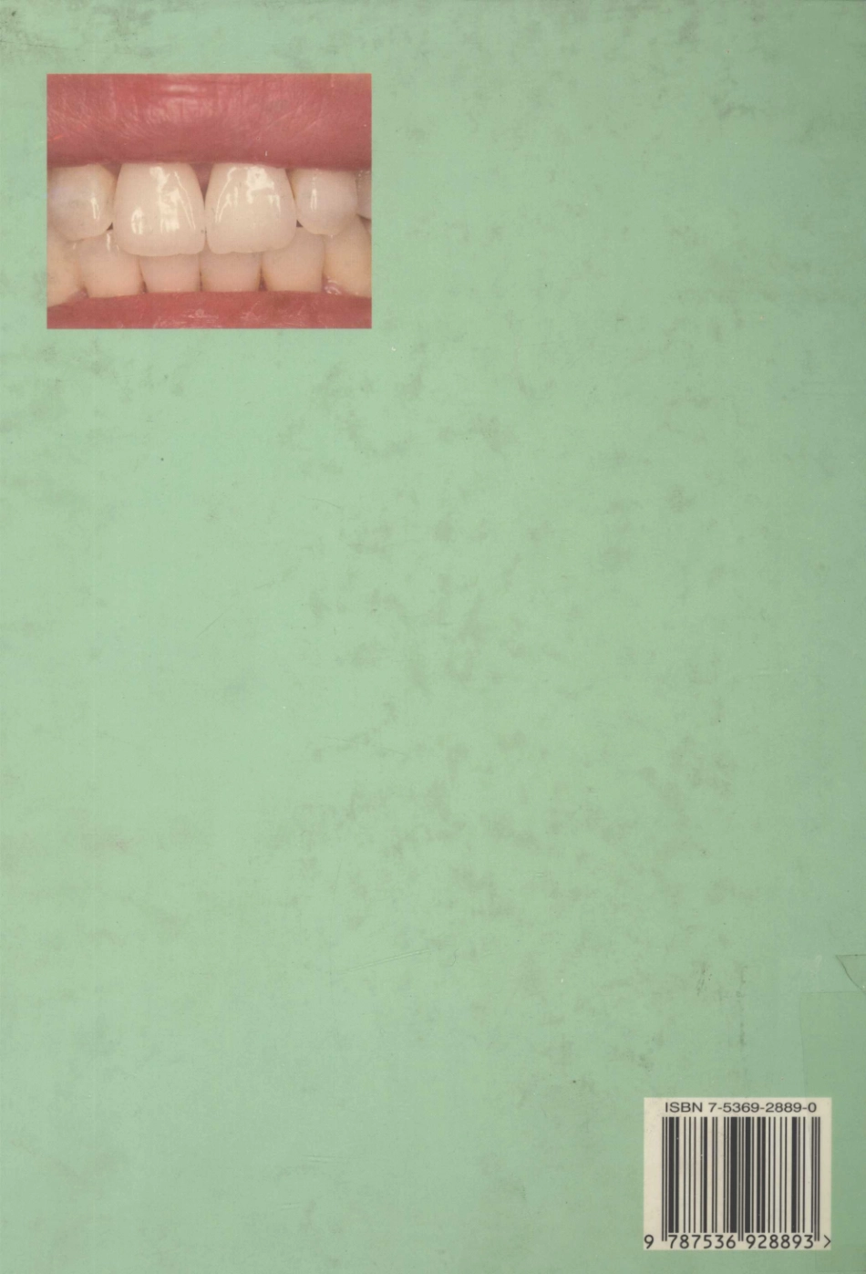 现代临床金属烤瓷修复学_陈吉华森修一永野清司编著.pdf_第2页