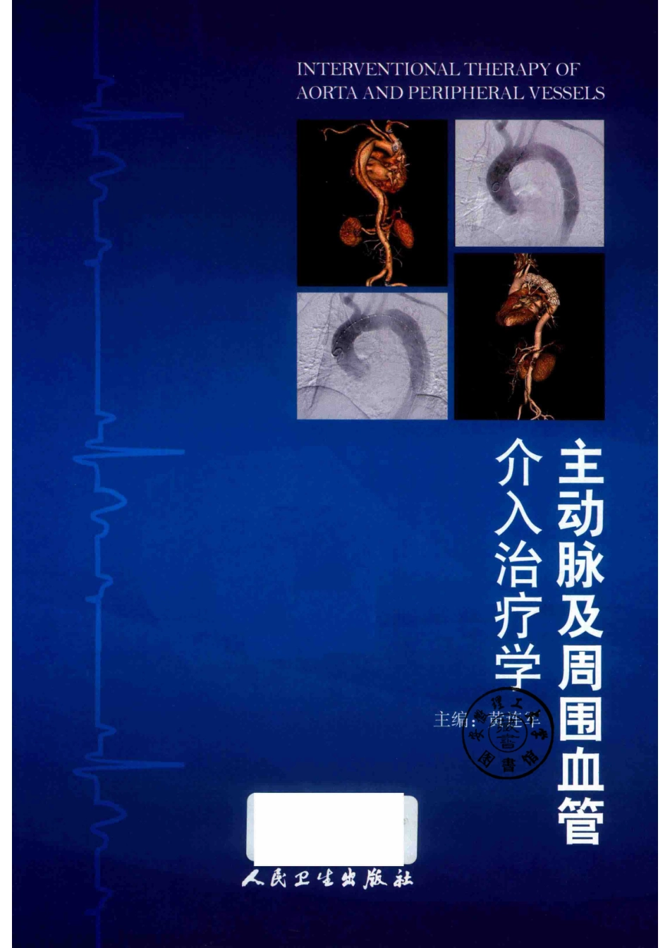 主动脉及周围血管介入治疗学_14553716.pdf_第2页