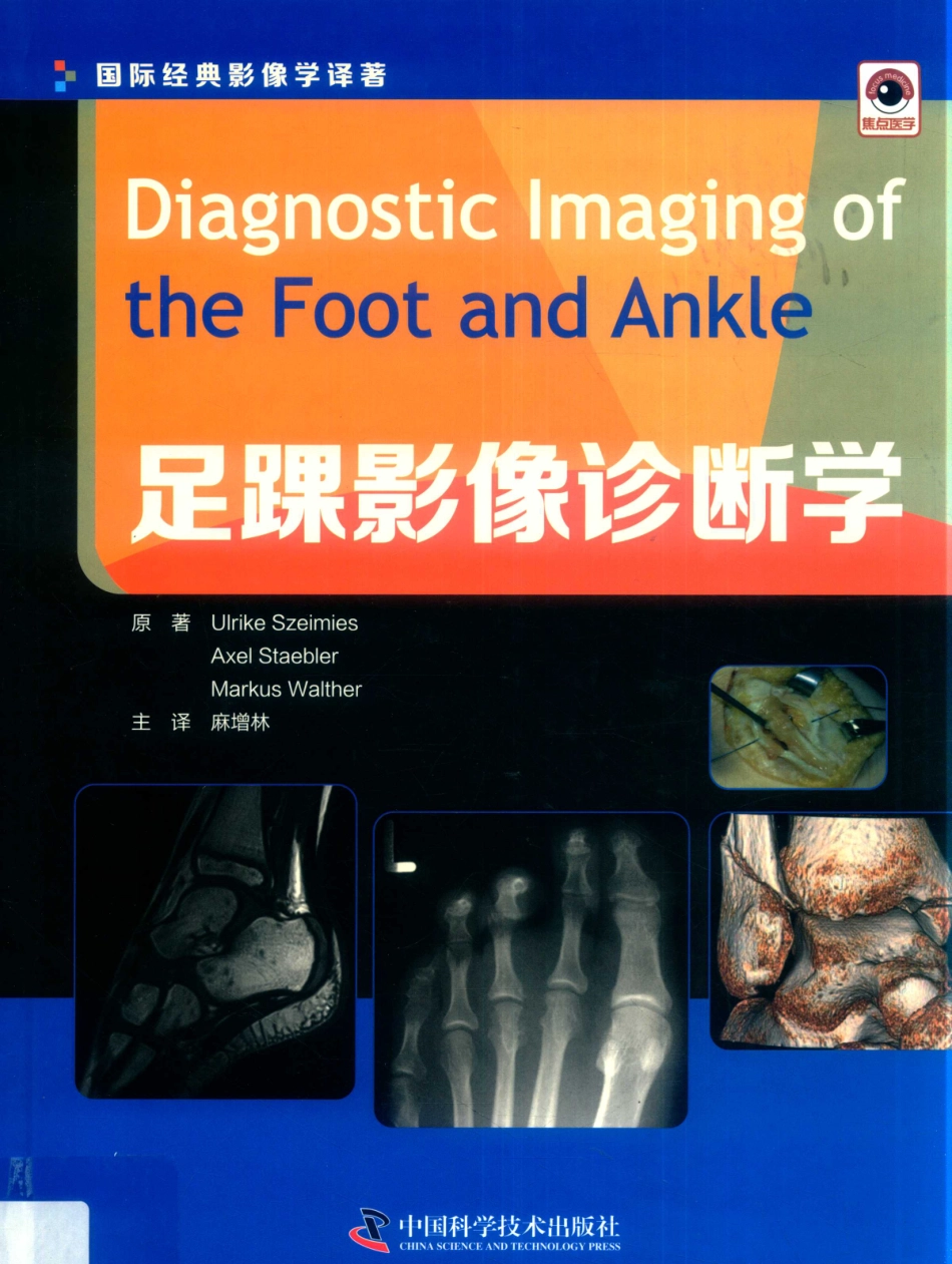 足踝影像诊断学2018版_（德）阿克塞尔·斯蔡密斯（德）马库斯·瓦尔特原著；麻增林主译.pdf_第1页