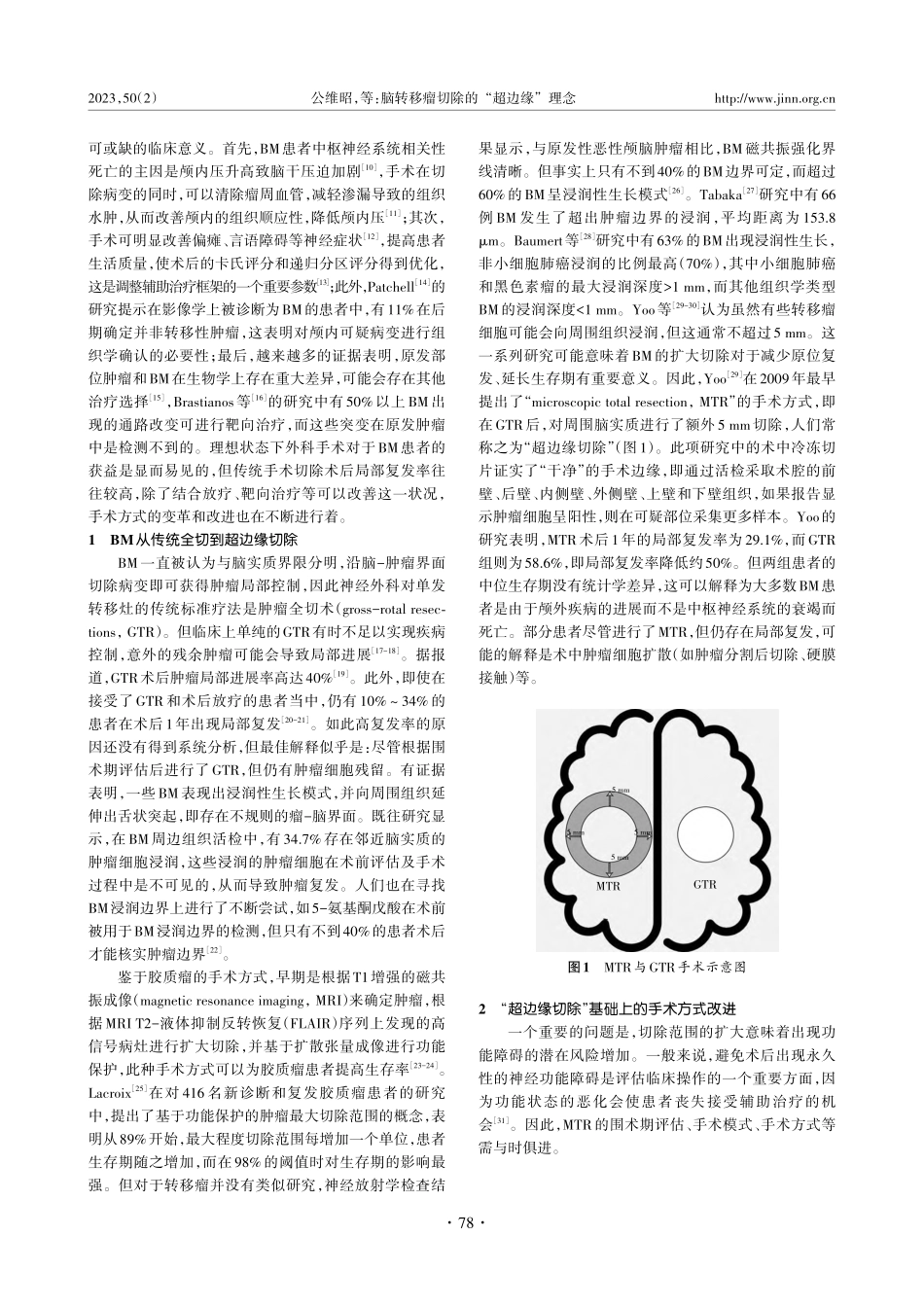 脑转移瘤切除的“超边缘”理念_公维昭.pdf_第2页