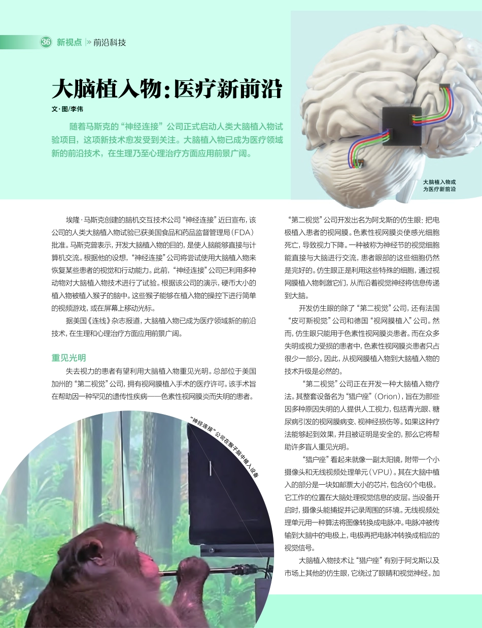 大脑植入物：医疗新前沿_李伟.pdf_第1页