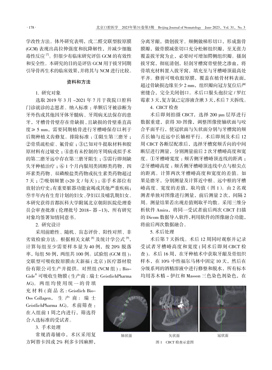 交联型可吸收胶原膜应用于拔牙同期引导骨再生的临床研究_赵倩.pdf_第2页