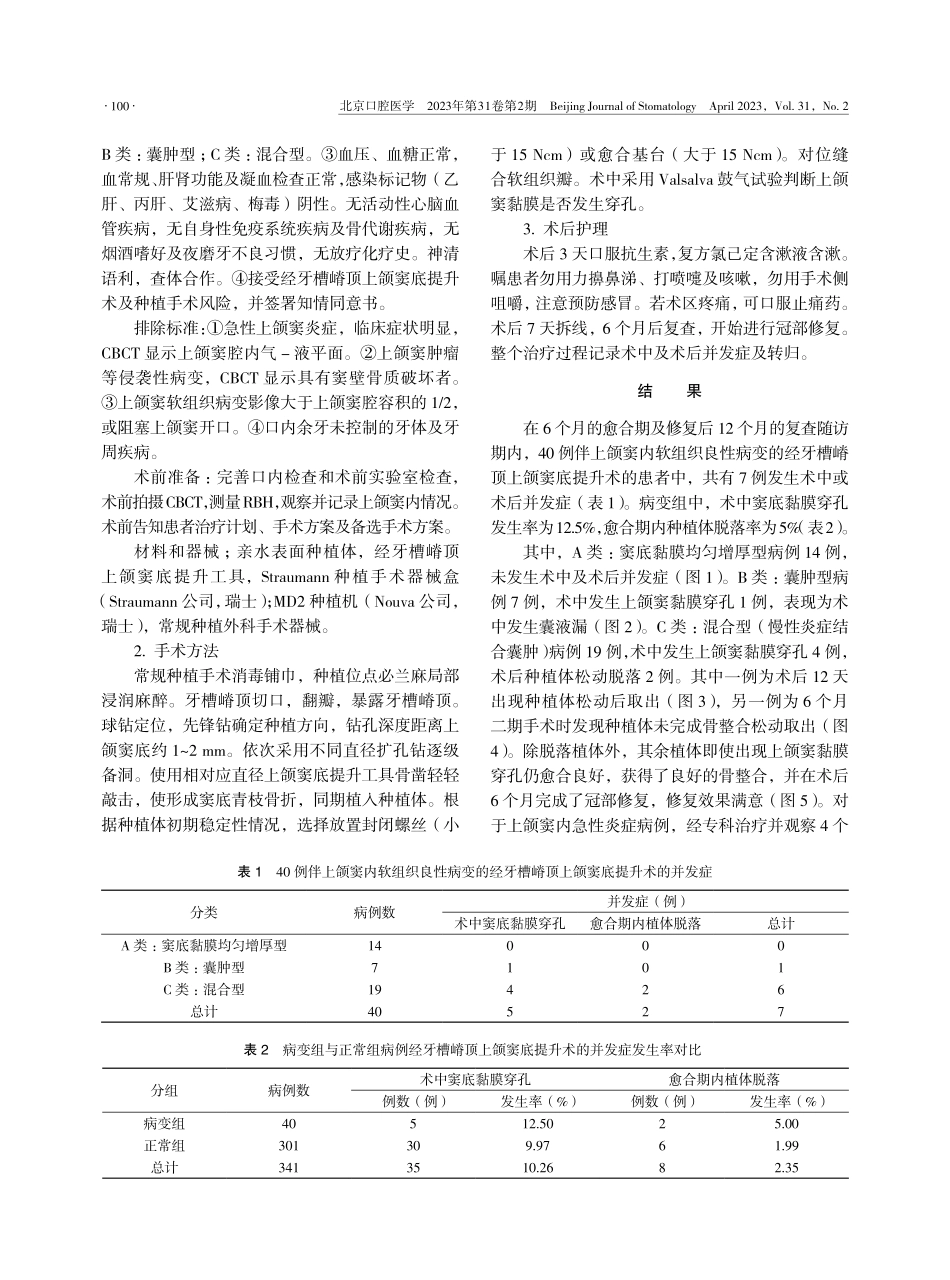 伴上颌窦内软组织良性病变影像的经牙槽嵴顶上颌窦底提升术病例回顾.pdf_第2页