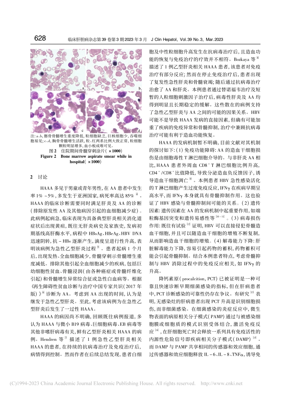 急性乙型肝炎合并一过性再生障碍性贫血1例报告_张玉.pdf_第3页