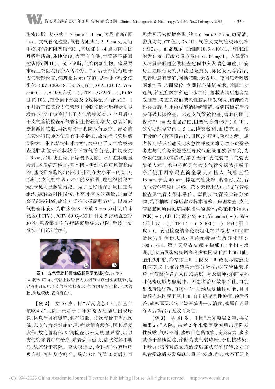 支气管腺样囊性癌误诊原因分析并文献复习_周兆珍.pdf_第2页